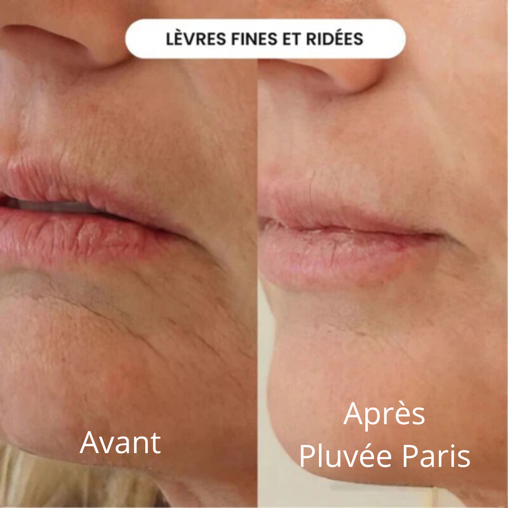 Micro-Infusion Kit Skin Boost+ | Pluvée Paris