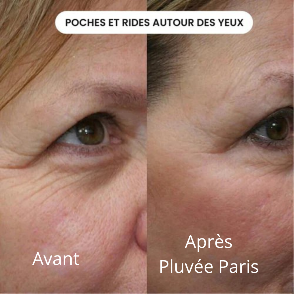 Micro-Infusion Kit Skin Boost+ | Pluvée Paris