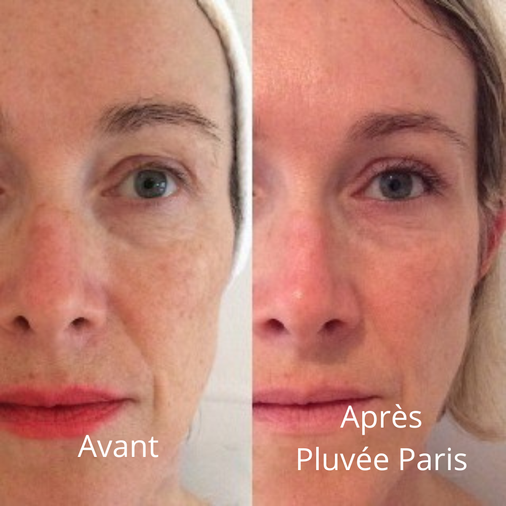 Micro-Infusion Kit Skin Boost+ | Pluvée Paris