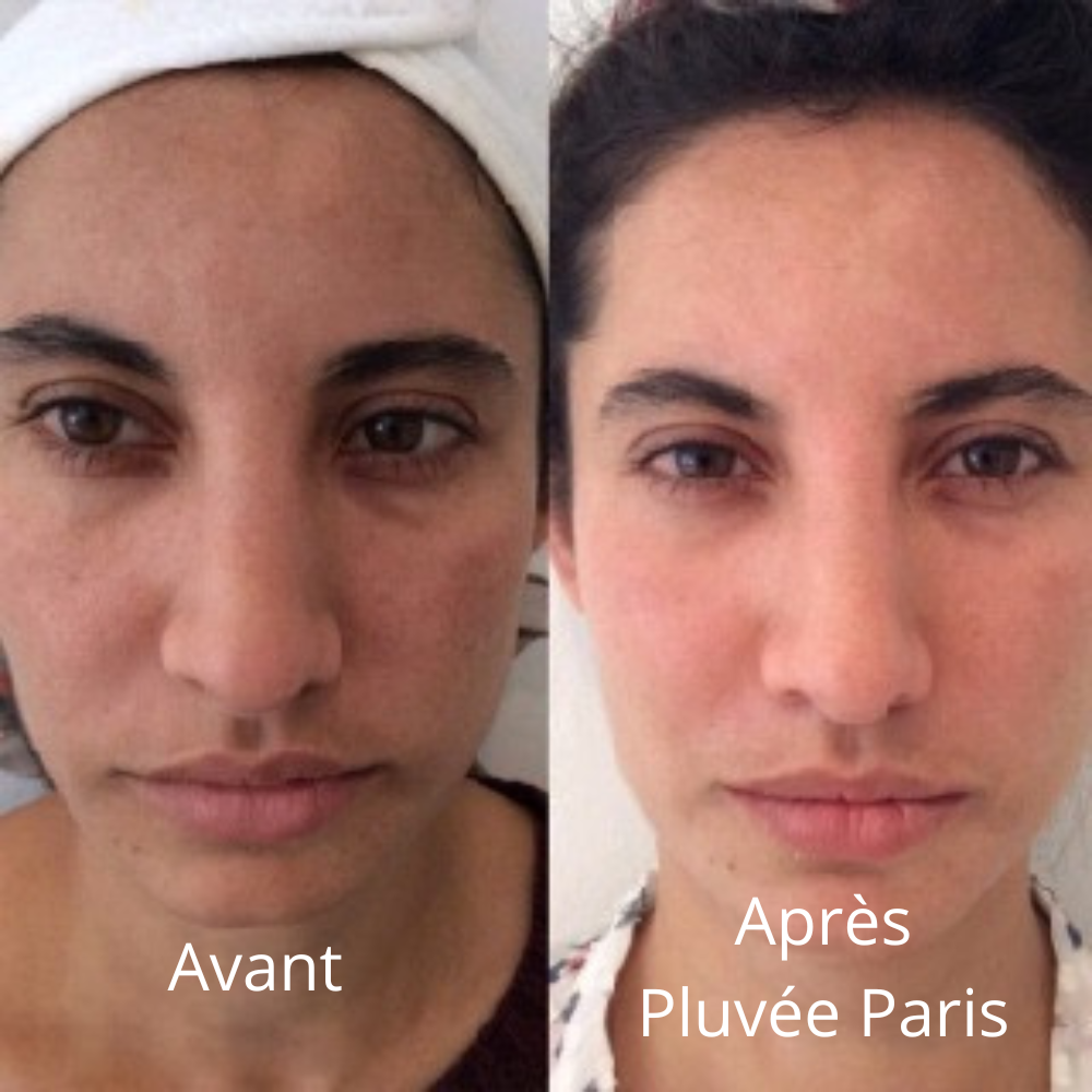 Micro-Infusion Kit Skin Boost+ | Pluvée Paris