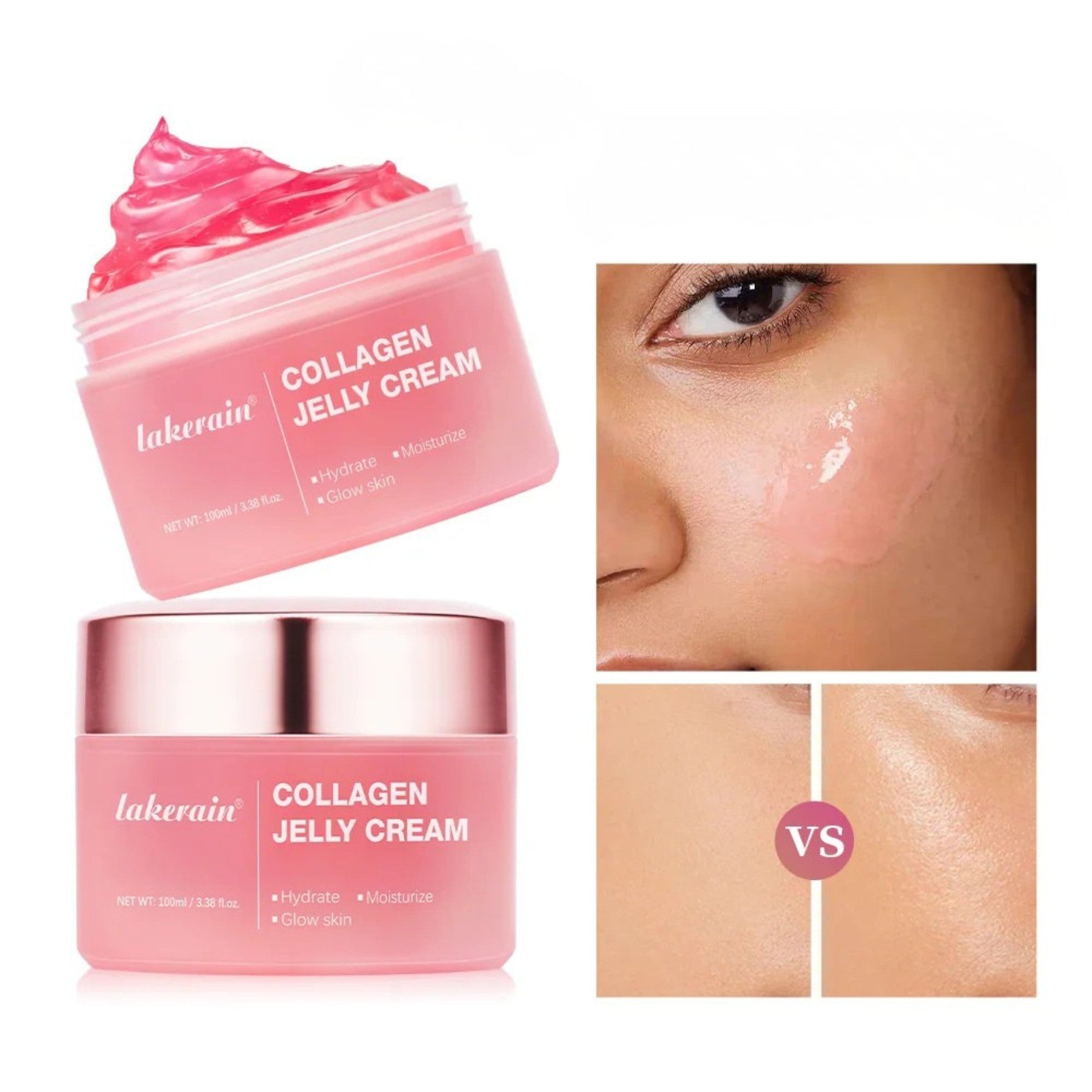 Résultats avant après de la crème au collagène et niacinamide jelly