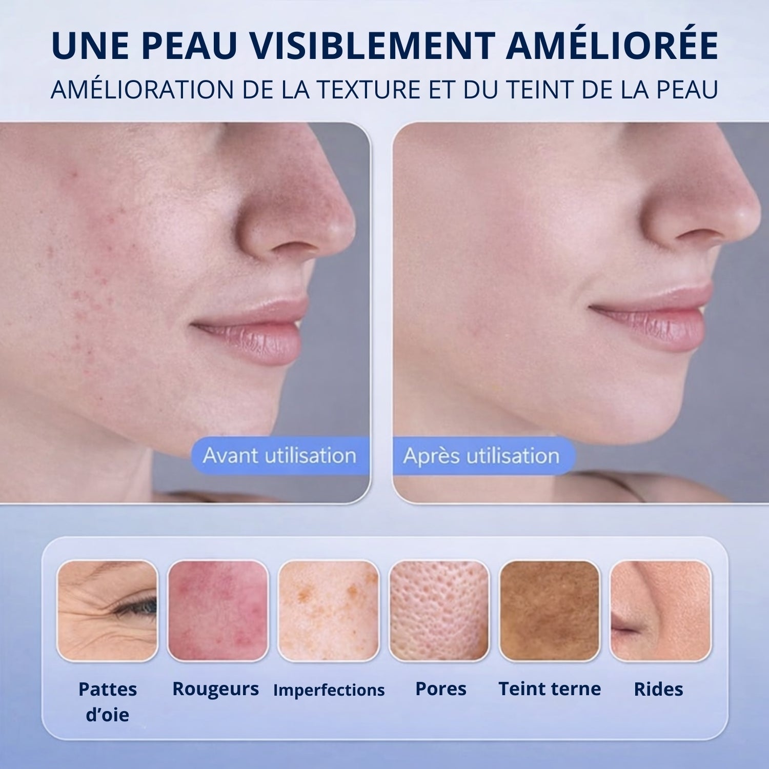 Resultats avant apres du masque LED visage sur la texture de la peau