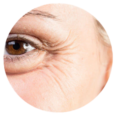 Sérum coréen au collagène Biodance – amélioration de l’acné et réduction des imperfections cutanées