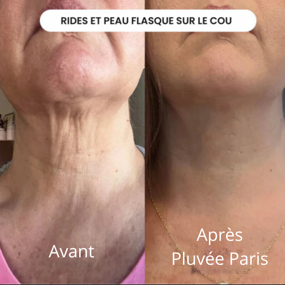 Micro-Infusion Kit Skin Boost+ | Pluvée Paris