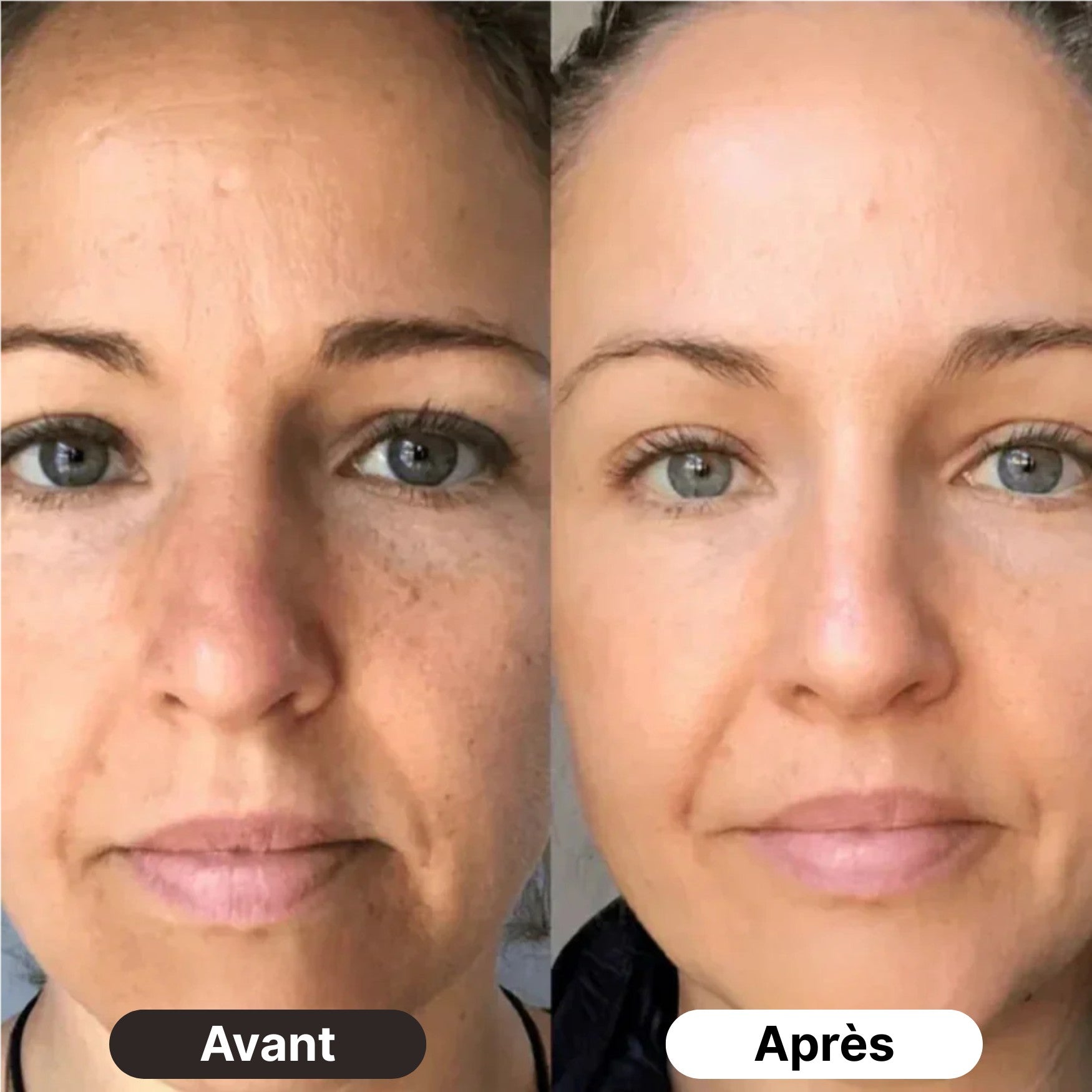 Résultats avant après de la crème au collagène jelly pour peau plus ferme