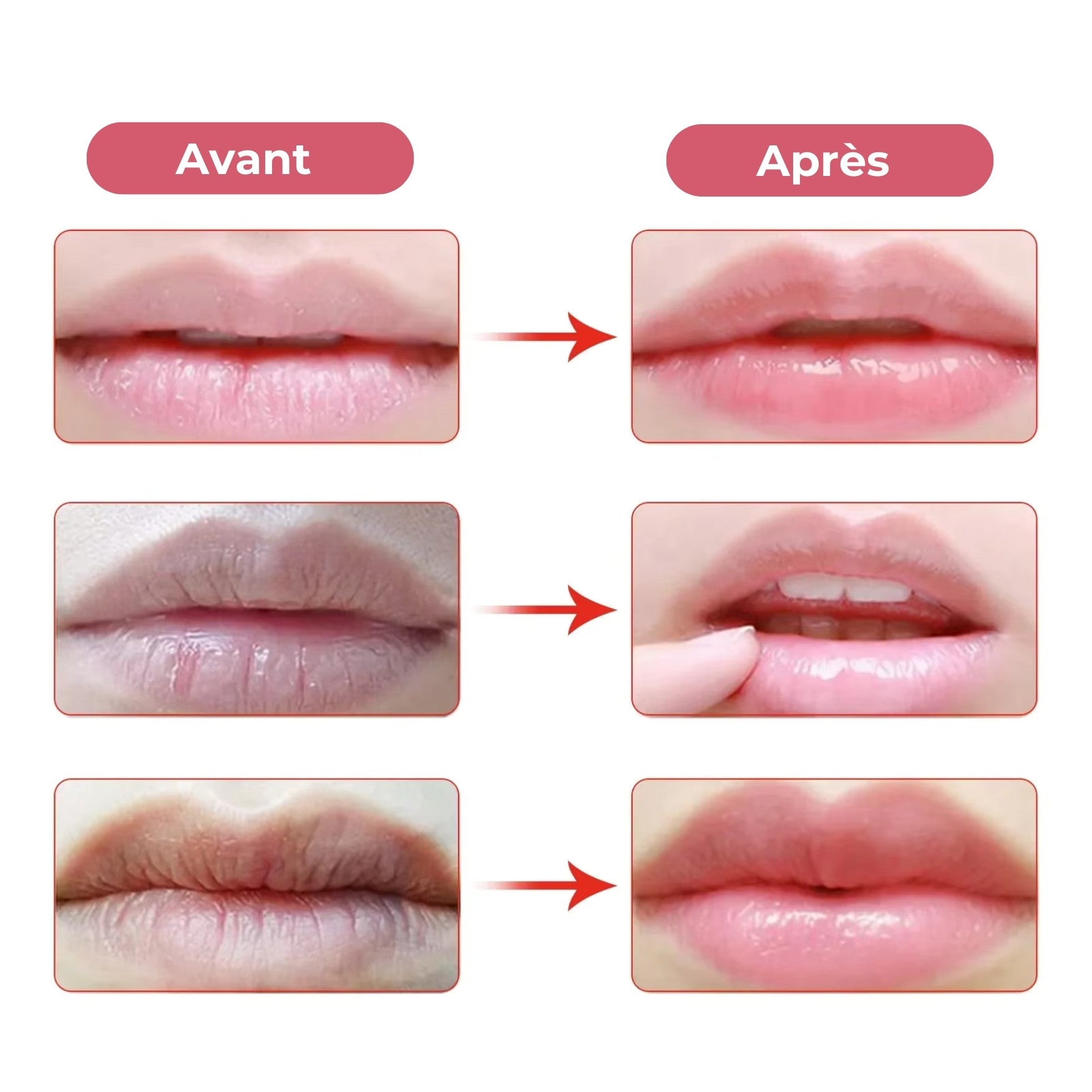 Résultat avant après du masque lèvres hydratant, diminution des ridules et lèvres plus lisses