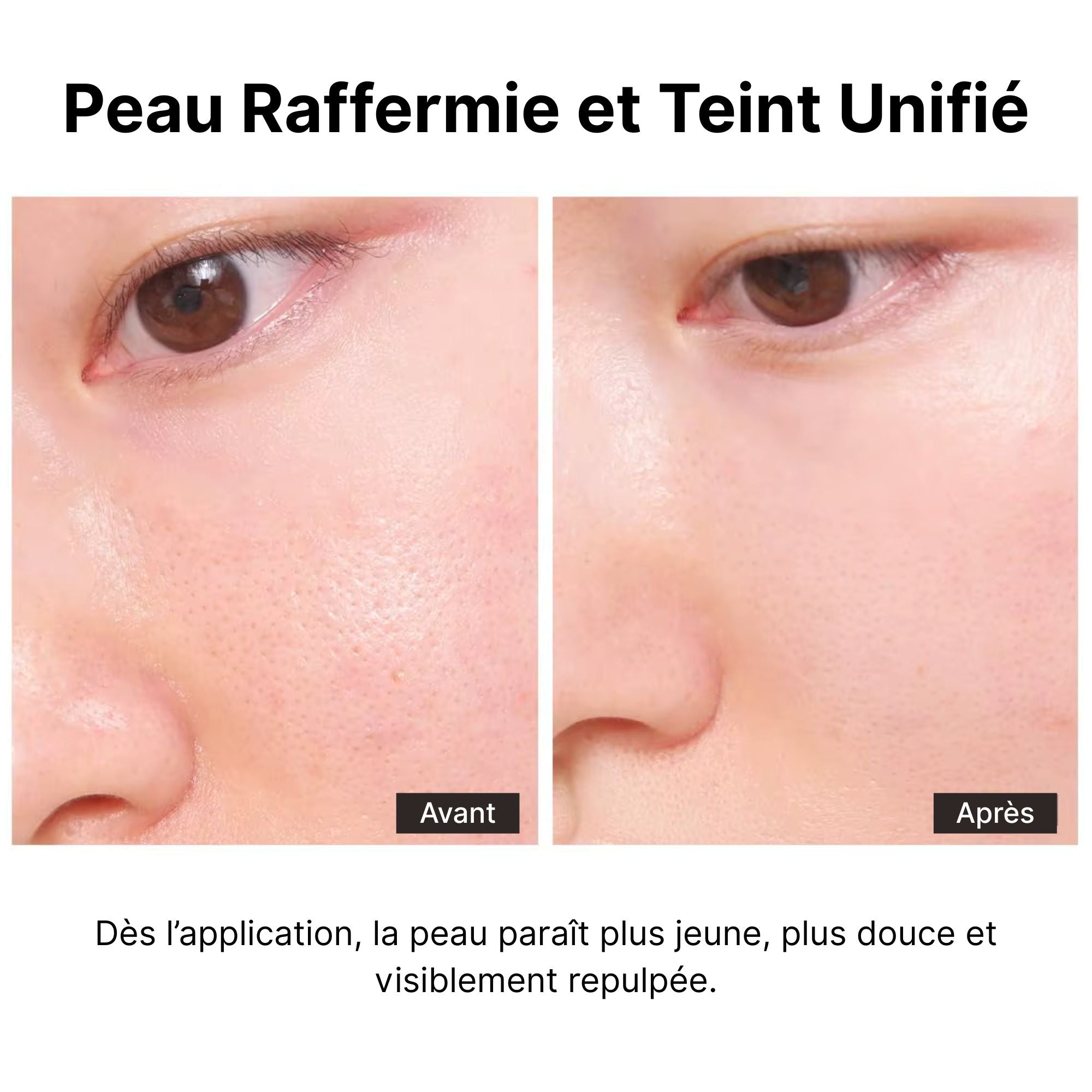 Avant après sérum au collagène – pores resserrés, peau lissée et grain affiné
