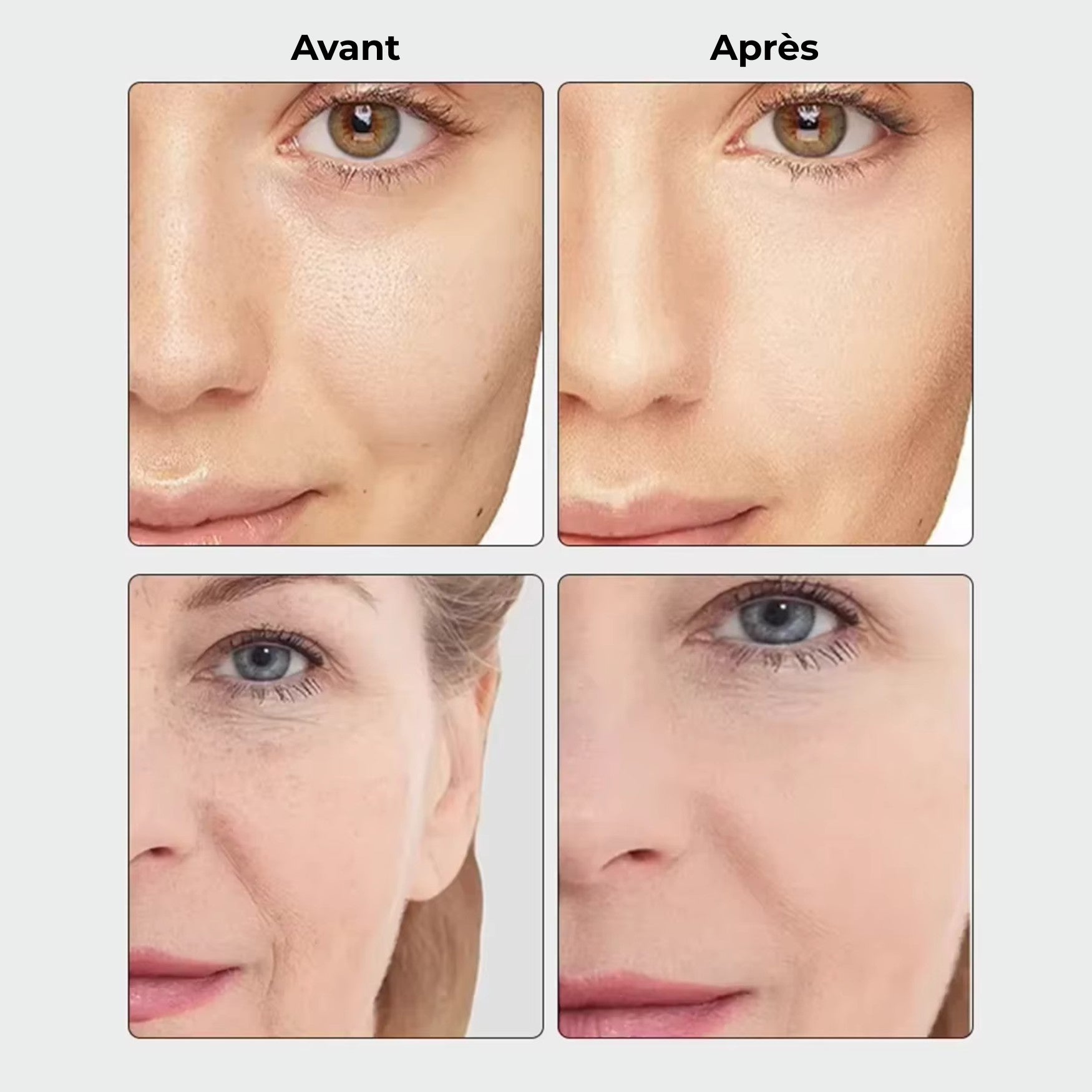 Comparaison avant après d’un soin visage EMS LED montrant une peau plus lisse, ferme et lumineuse