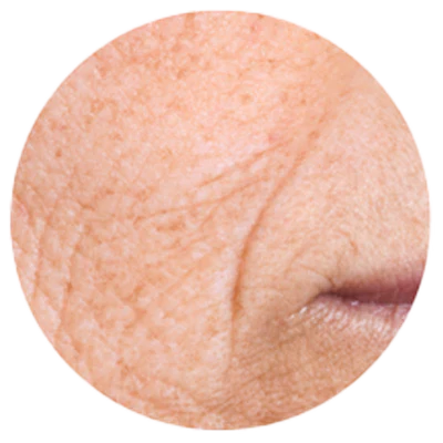 Sérum anti-âge au collagène qui réduit les rides fines et apporte un effet repulpant immédiat
